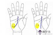 測雙方八字：月丘有痣是好命運的手相嗎？