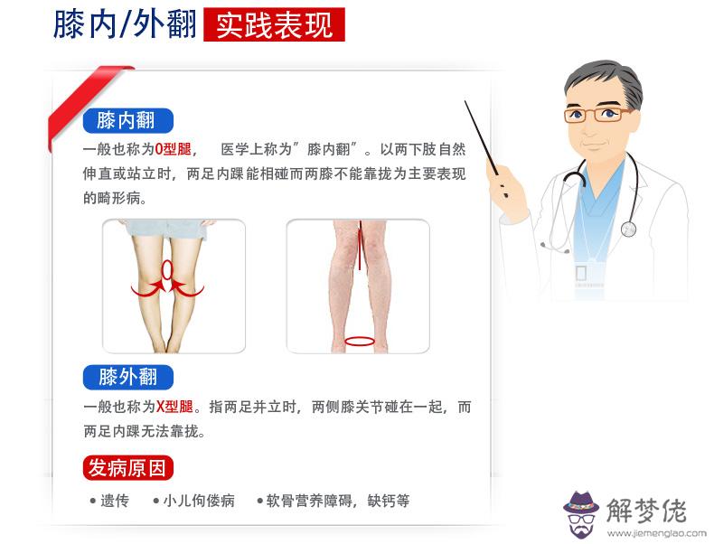 如何糾正內八字：外八字腳怎麼矯正 妙招解決煩惱