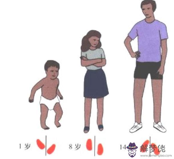 嚴重內八字腳圖片：30歲了腳內八該怎麼辦