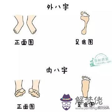 小孩走路外八字