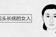 舌頭長痣的女人是富貴命嗎