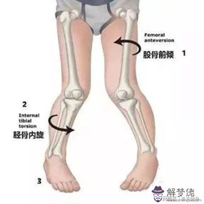 包含一歲半寶寶走路內八字怎麼回事的詞條