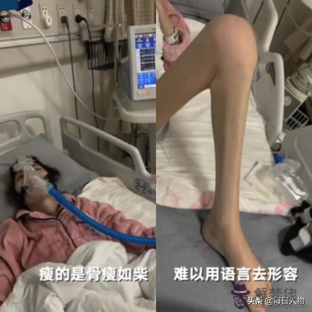 算命的說外科病是什麼意思