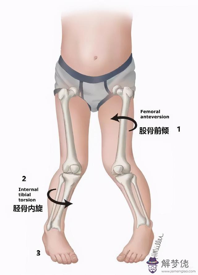 十一歲內八字矯正