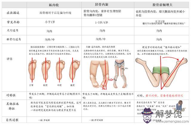 寶寶走路內八字圖