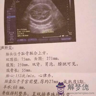 2、懷孕多久可以看出性別:幫忙看看四維單子是男是女謝謝