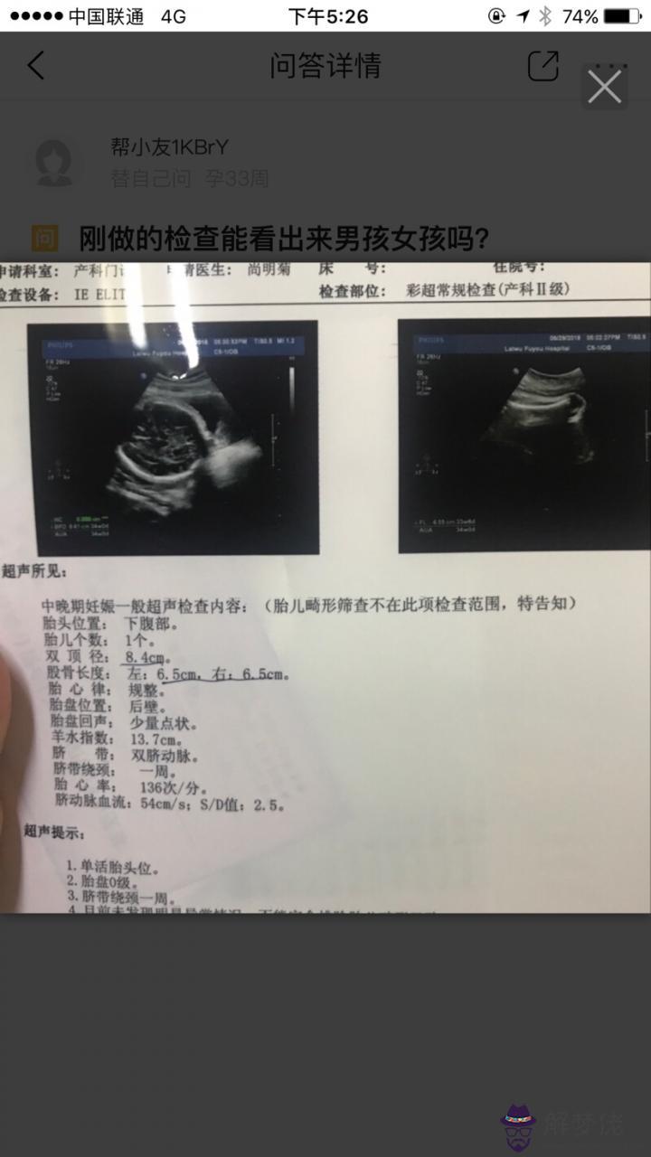 4、懷孕多久可以看出性別:驗血鑒別男女只要有7周就可以驗了嗎