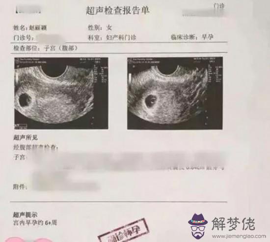 3、懷孕后b超看不到是怎麼回事:懷孕幾天為何做B超卻檢查不出來胎兒在宮內