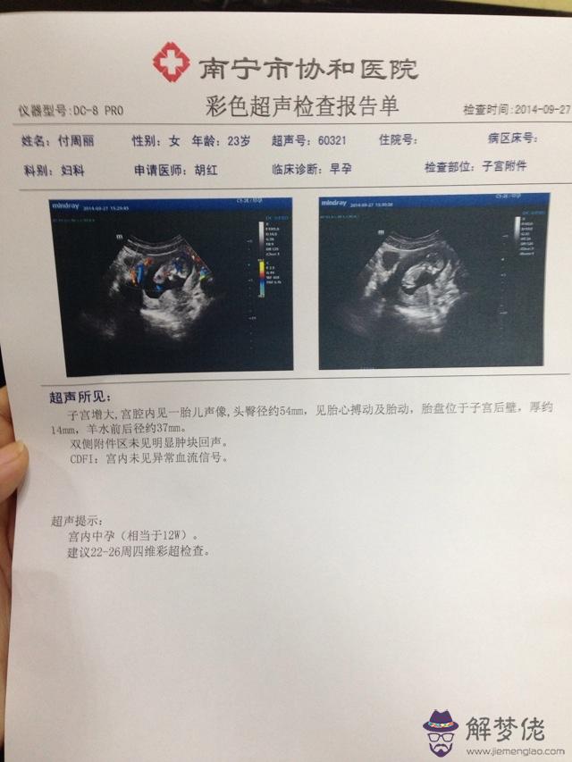 1、懷孕是男是女的征兆怎麼判斷:懷兒子的特征最準的：