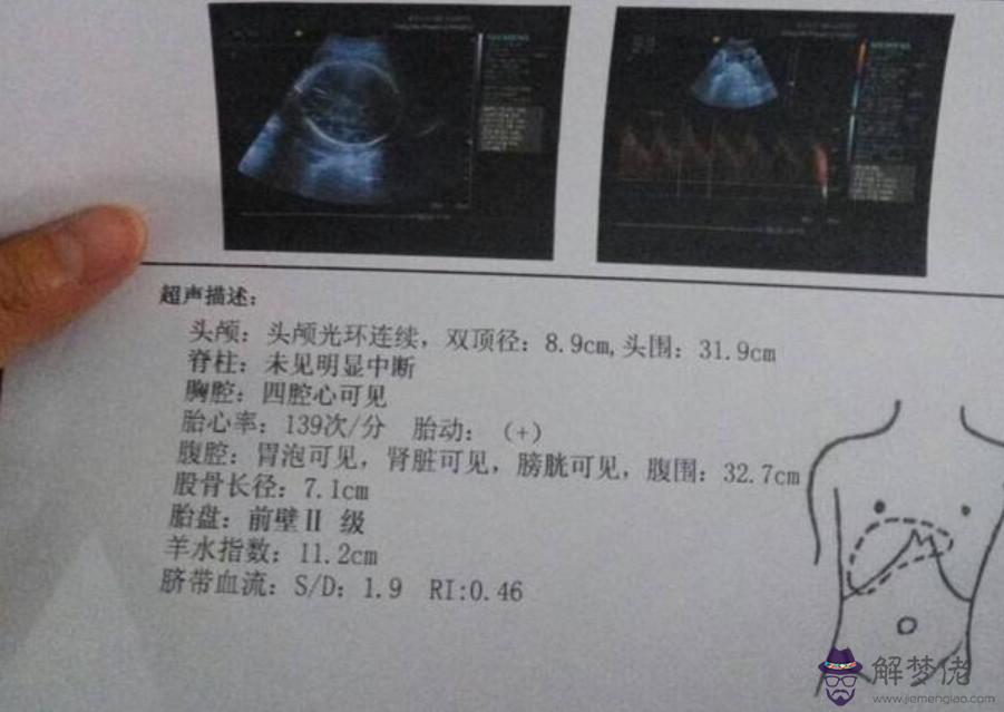 2、一般幾月份懷孕**:備孕的時間很重要，一年中幾月懷孕**？