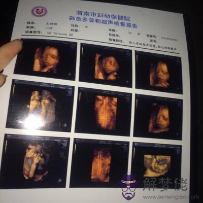 5、四維彩超看男胎兒圖:你**次看到寶寶的四維彩超照片，是什麼感覺？