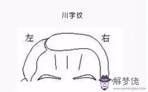 解讀川字紋和抬頭紋區別是什麼？