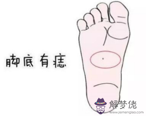 男人右腳底有痣代表什麼， 男人右腳底有痣好不好