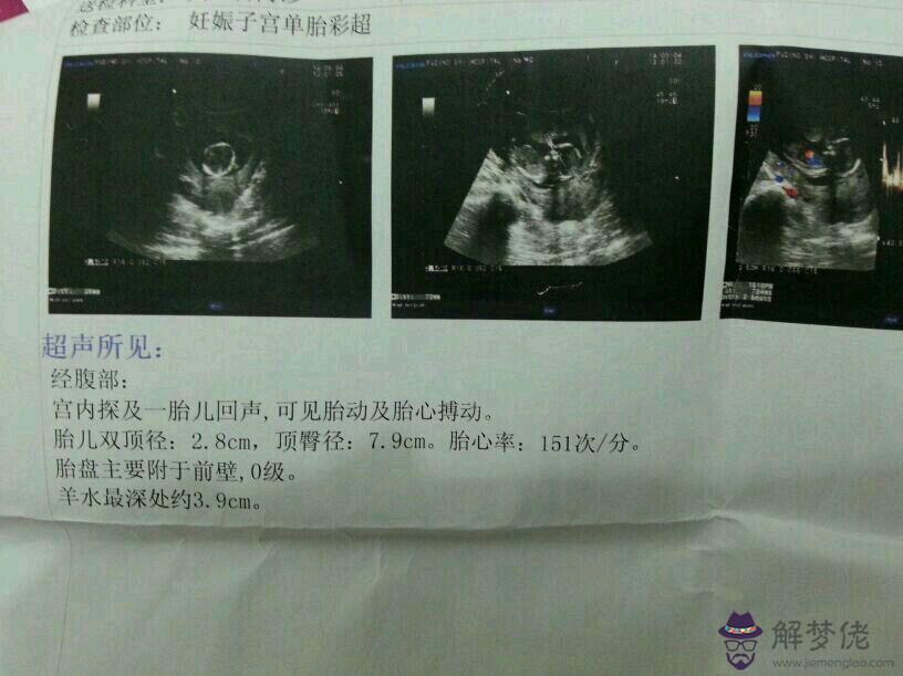 10秒測出懷男孩和女孩：說說我是怎麼10秒測出懷男孩和女孩的，方法