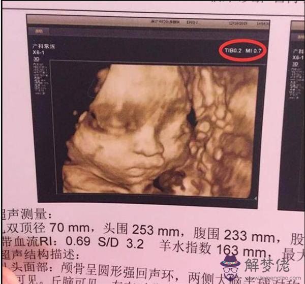 懷孕生男孩的18個癥狀：孕婦生男孩的身體特征和表現