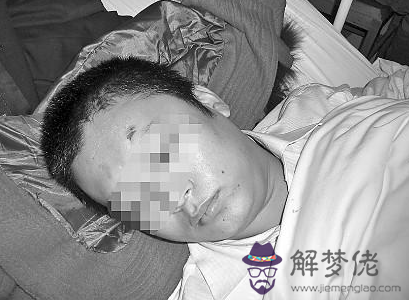 夢見老公被人打意味著什麽 第1张