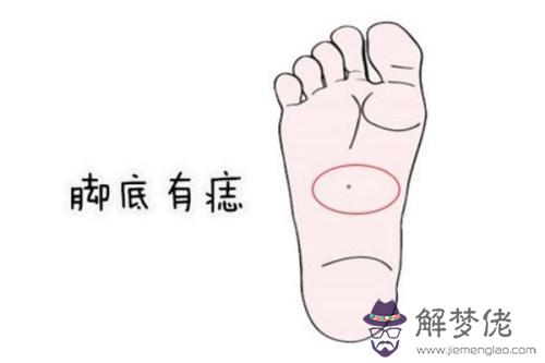 了解算命腳底上長痣是什麽意思 腳底長痣好嗎 第1张