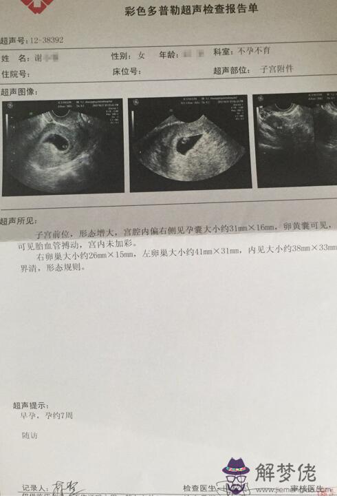 2、驗孕棒測出來懷孕b超看不見:驗孕棒顯示是已經懷孕，為什麼做b超顯示沒有呢