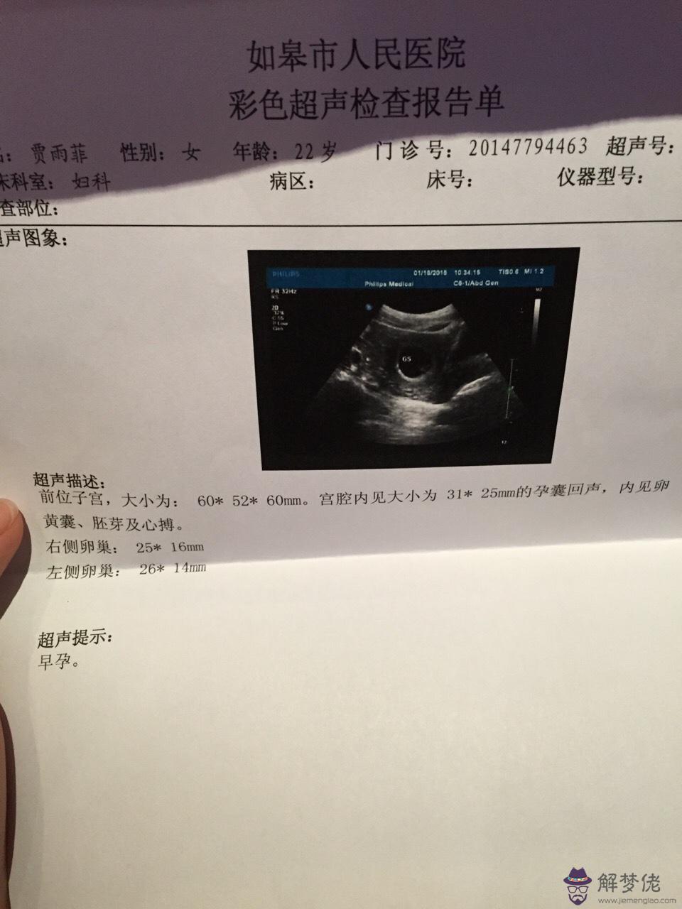 為什麼結婚了就有孩子了？父母也生的我們，怎麼才能懷上孩子？