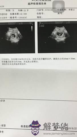 懷孕95天檢查女孩準不：懷孕16周B超檢查為女孩，翻盤的幾率多大