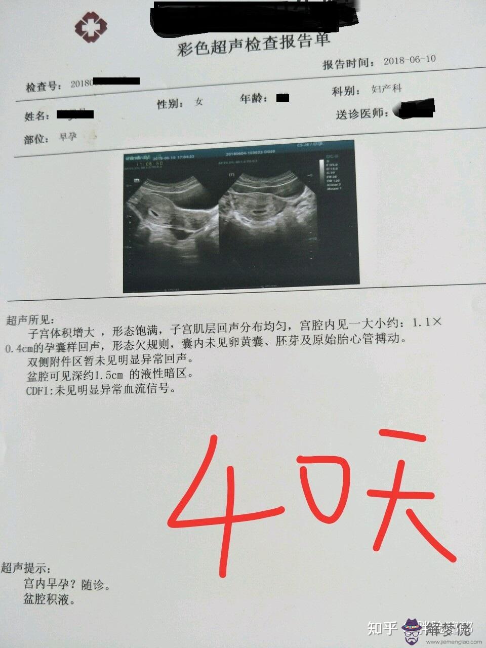 孕囊大小與孕周對照表：如何通過胎囊大小推算孕周