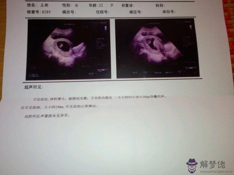 懷孕六周怎麼判斷男孩女孩：懷孕六周如何辨別男女？