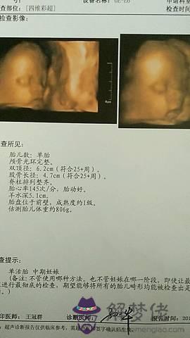 怎樣在家測男女比較準確率：怎麼測男女寶寶最準