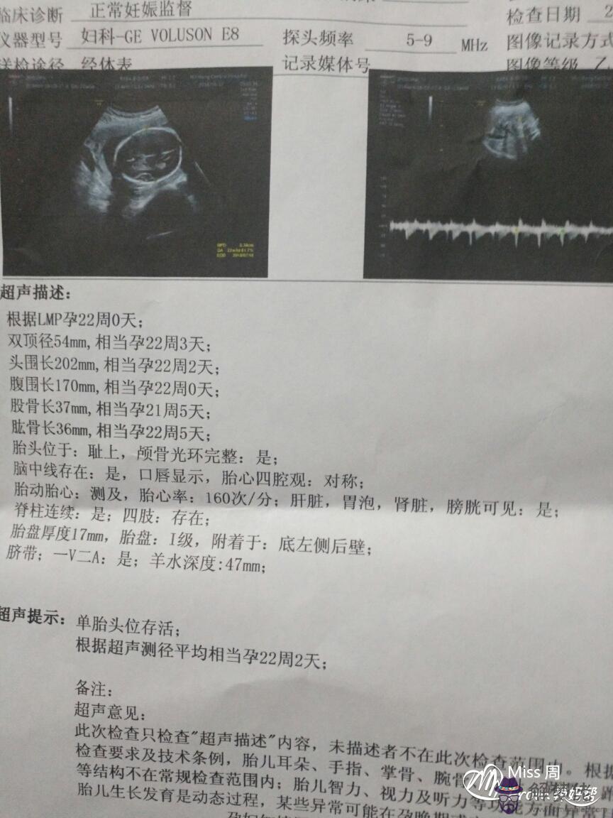 單年單月懷孕是男是女：哪一種生男生女計算法特別準