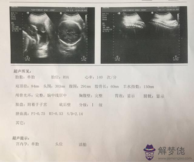 b超判斷男孩女孩最準方法：怎麼判斷男孩女孩最準確