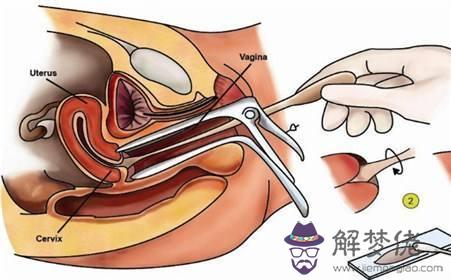 懷疑自己懷孕怎樣確定：什麼時候會開始懷疑自己懷孕了？