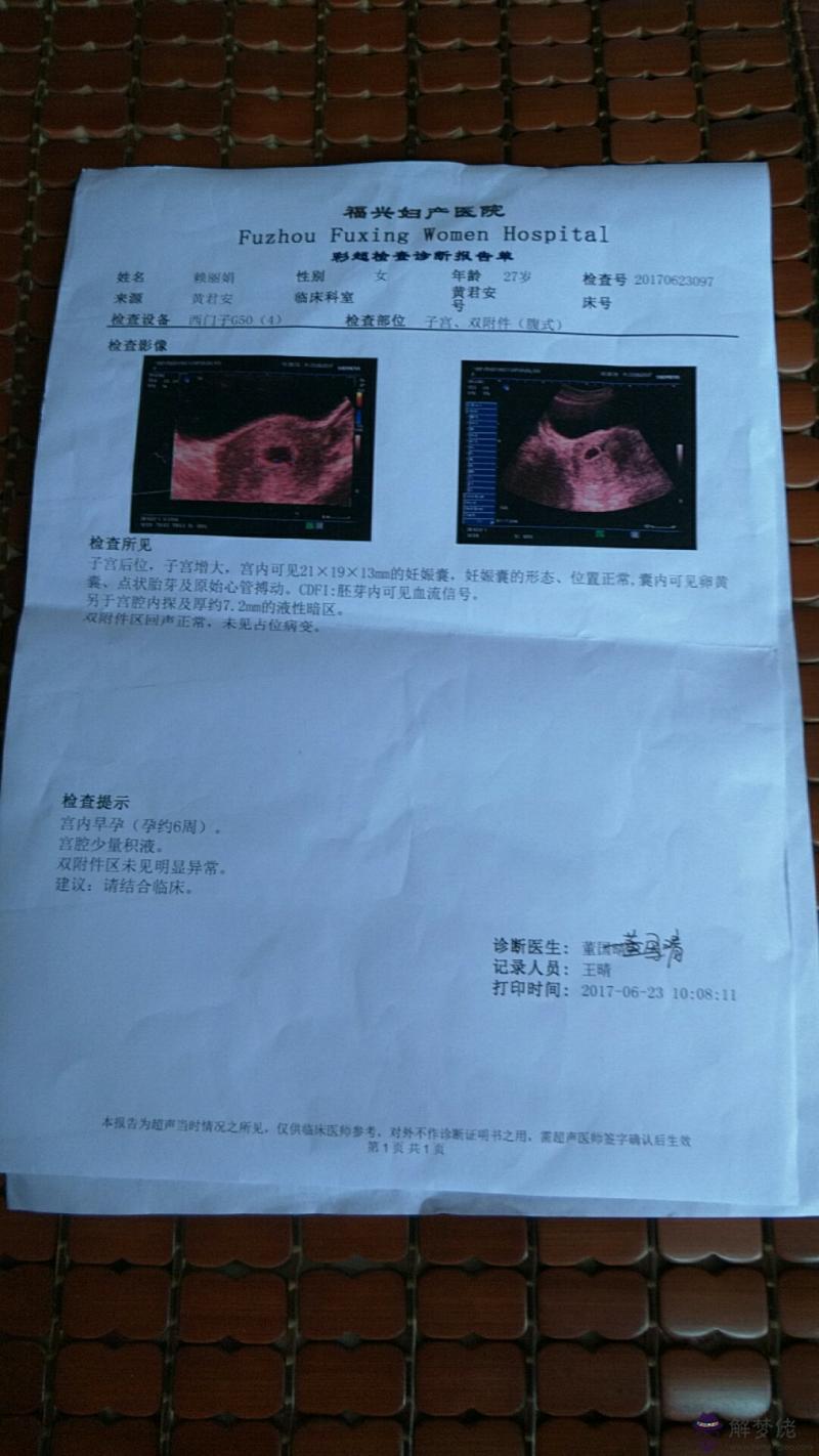 懷孕怎麼推算孩子性別：算懷男孩女孩的計算公式是什麼