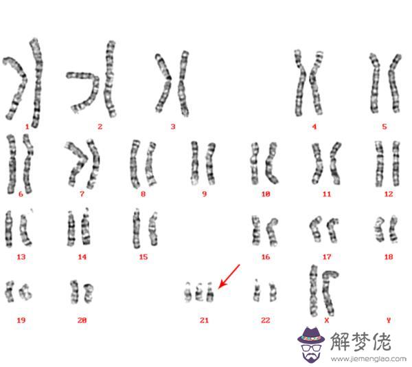 21三體數值越大越好：21三體風險值1:臨界風險代表什麼?