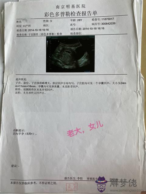 懷女兒的早孕反應比兒子重嗎：怎麼判斷自己懷的是男孩還是女孩?