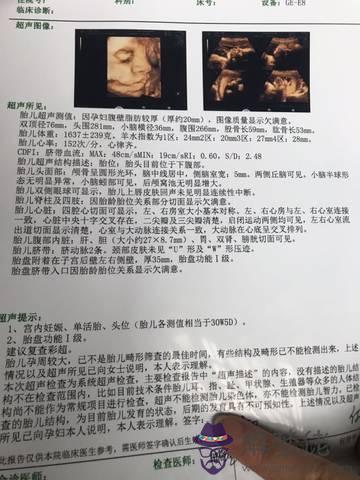 單歲數雙月份懷孕是男孩女孩：虛歲單歲又在單月懷孕是男孩還是女孩？