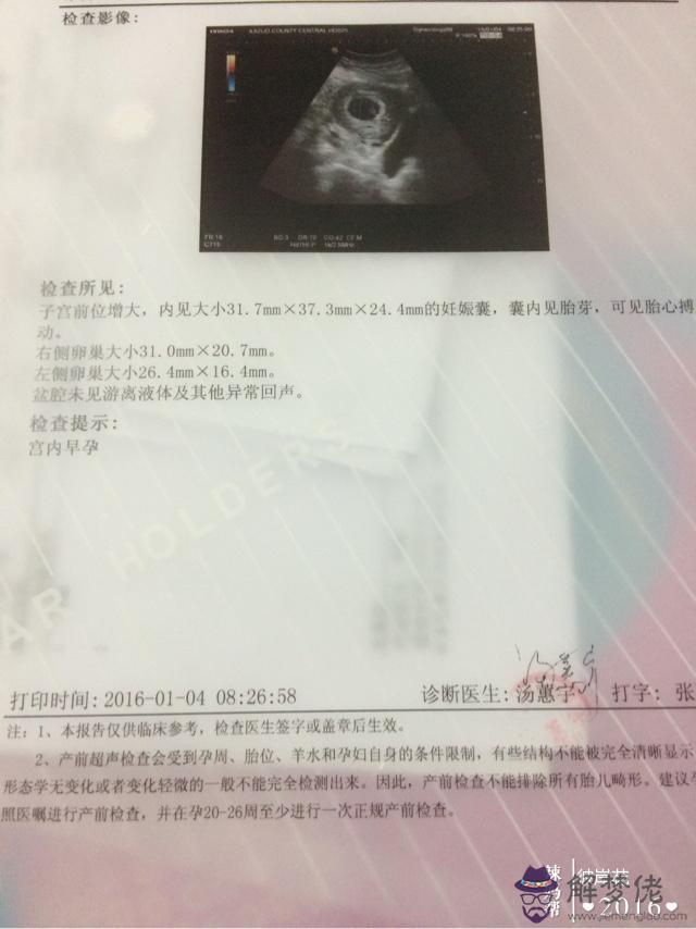 孕囊看男女是幾周最準：聽說看孕囊形狀可以大概猜出男女性別，準不準呢，幫我看下