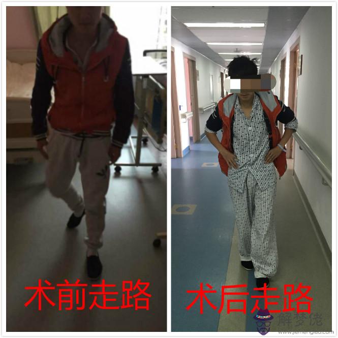 走路外八字男人的命運：男人走路外八字好看嘛？