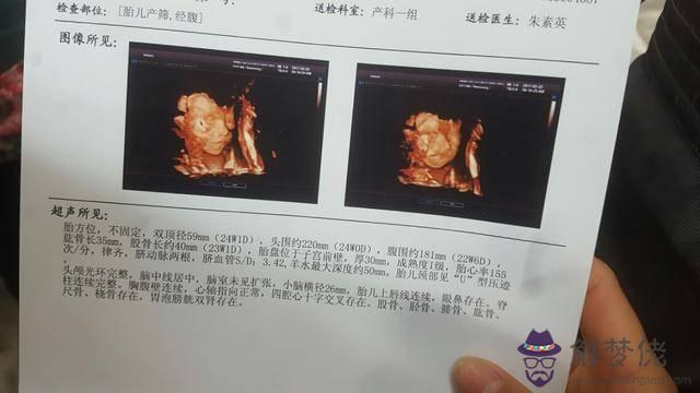 四維費用是多少:做四維大概要多少錢啊