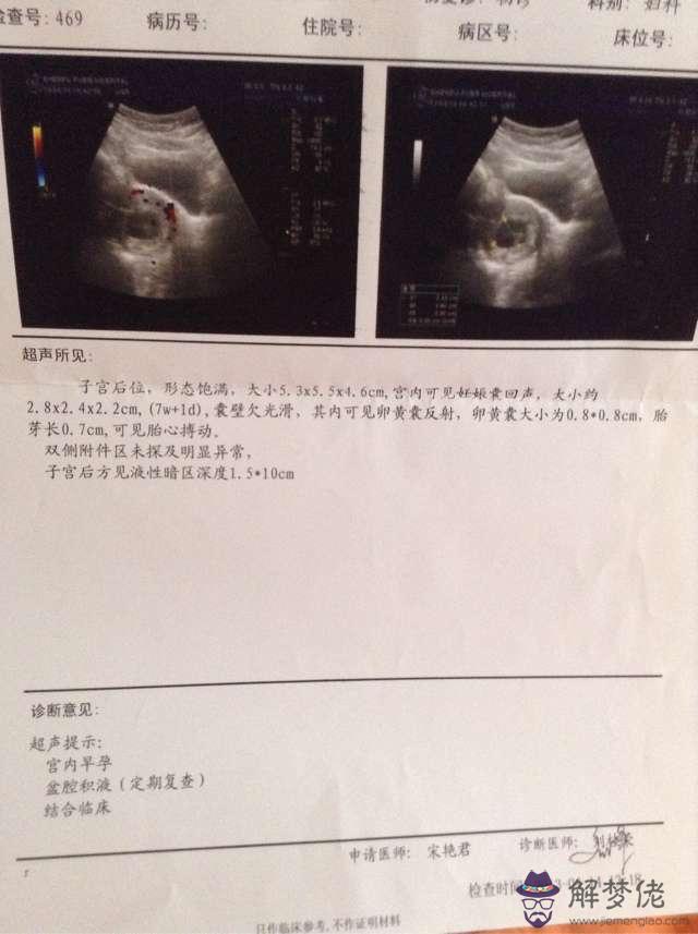 孕囊大小與孕周對照表:根據孕囊大小計算懷孕多少周