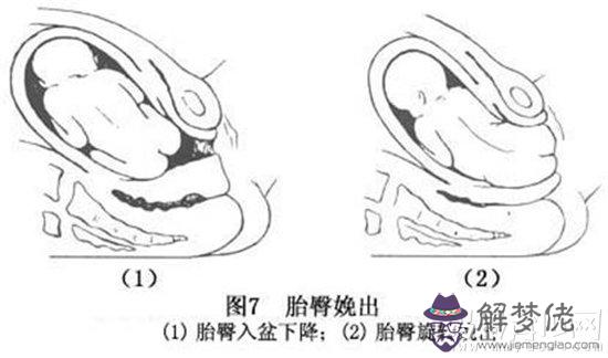 胎兒頂臀徑標準男女:胎兒頂臀長83mm是多少周的胎兒？