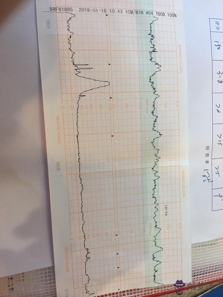 胎心監護不過關怎麼辦:孕38周 ，3次胎心監護不過關，會不會要被提前剖