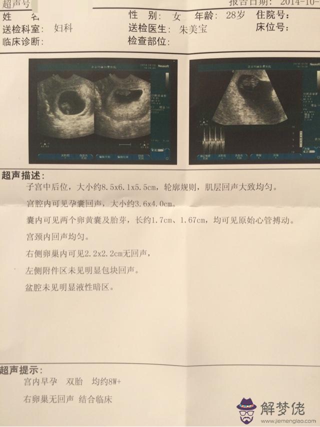 同卵雙胞胎是怎麼形成的:同卵雙胞胎長得不像，為啥