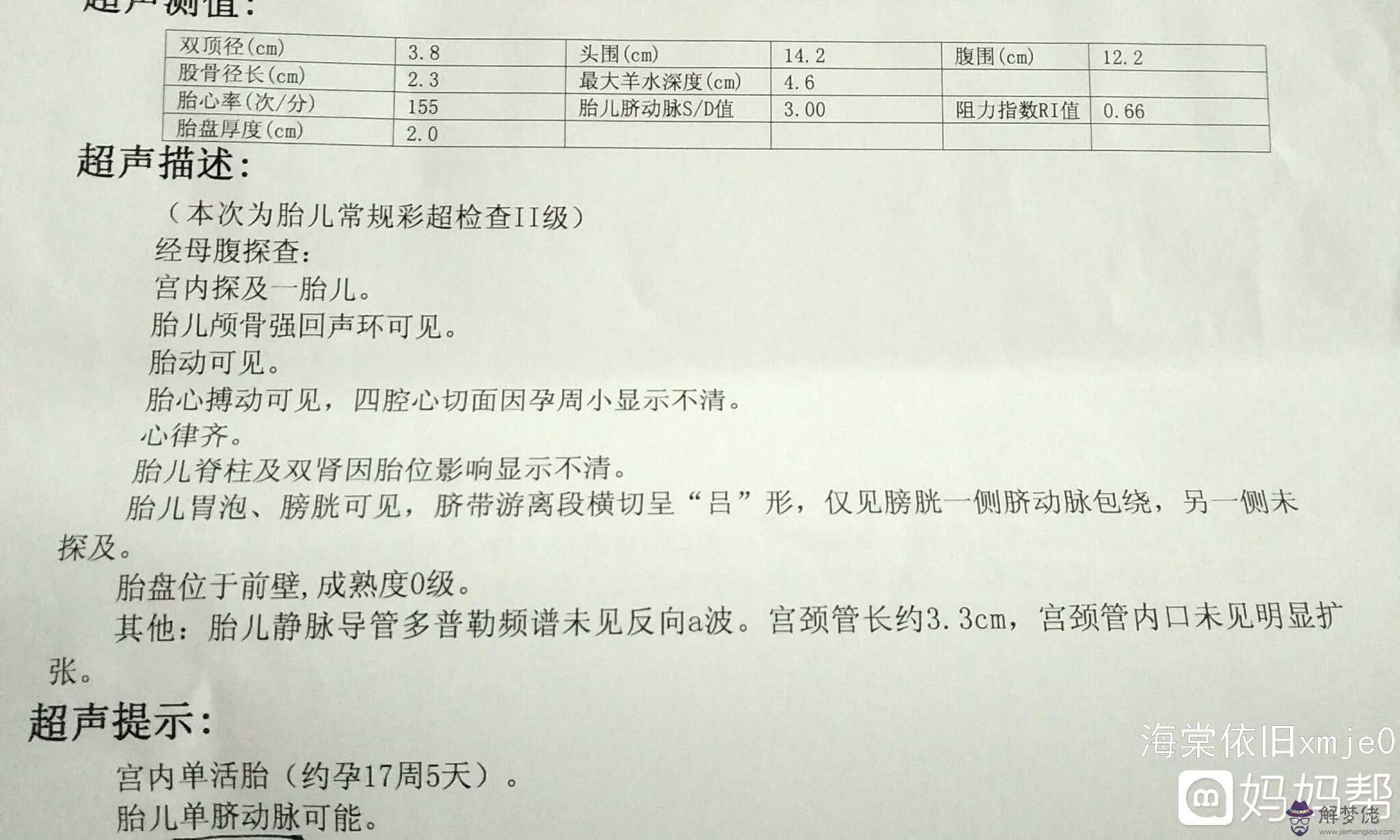 穿刺的風險:唐篩結果21三體1:146高風險寶寶能要嗎？ 寶寶知道