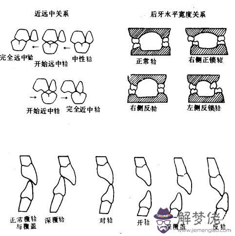 嘴巴有點歪怎麼糾正:看起來嘴不歪，但是說起話來嘴就有點歪了，怎麼辦